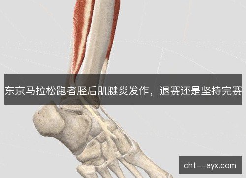 东京马拉松跑者胫后肌腱炎发作，退赛还是坚持完赛
